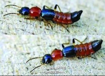 十一出游勿乱坐草坪 小心被毒隐翅虫咬伤